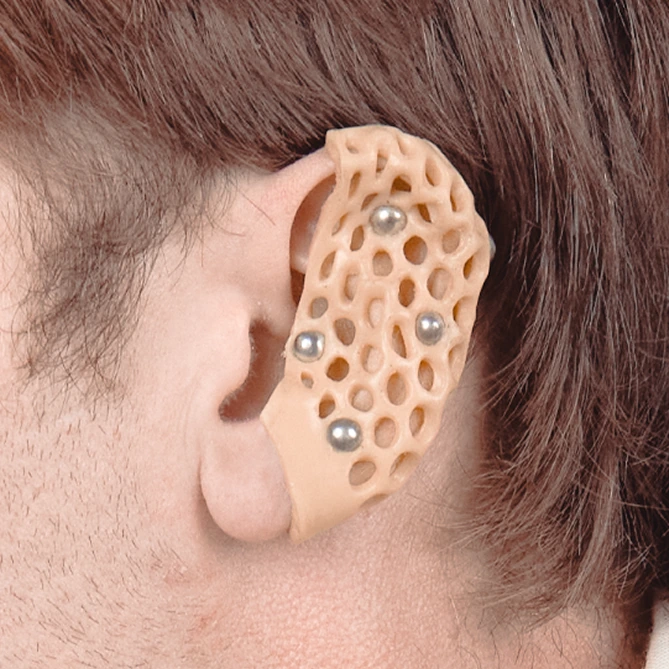 Earcuff